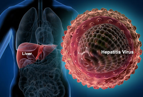 webmd rf photo of liver and hepatitis virus